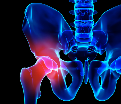 Types of Hip Injuries Buffalo Doctors Chiropractors Free Consultation